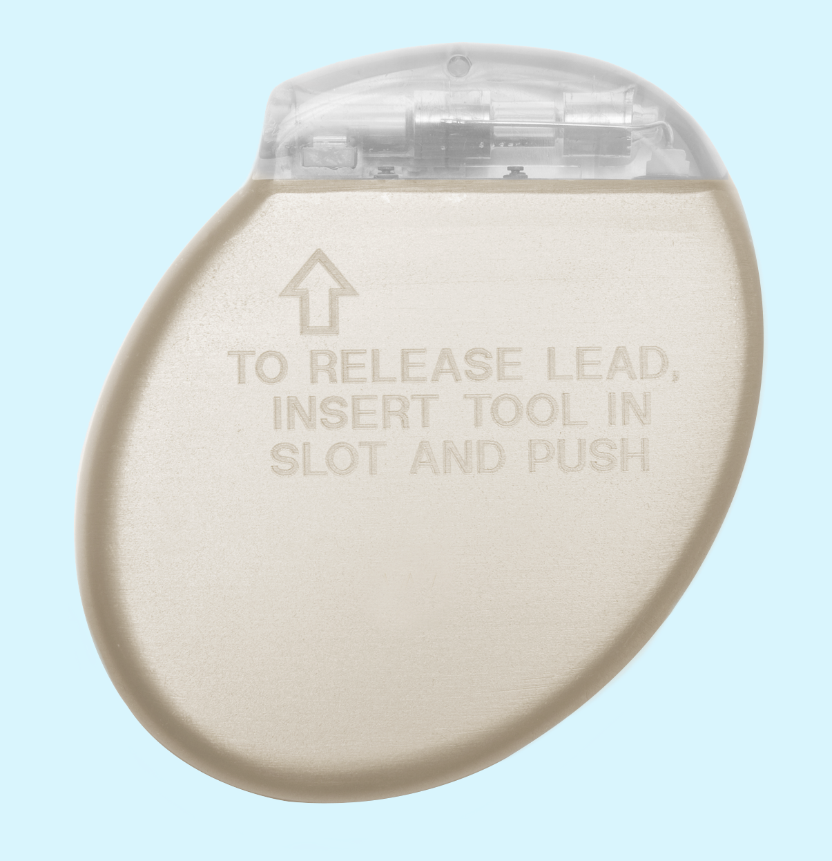 Implantable Fibrillation Ceramic