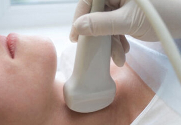 Ultrasound Flex Circuit